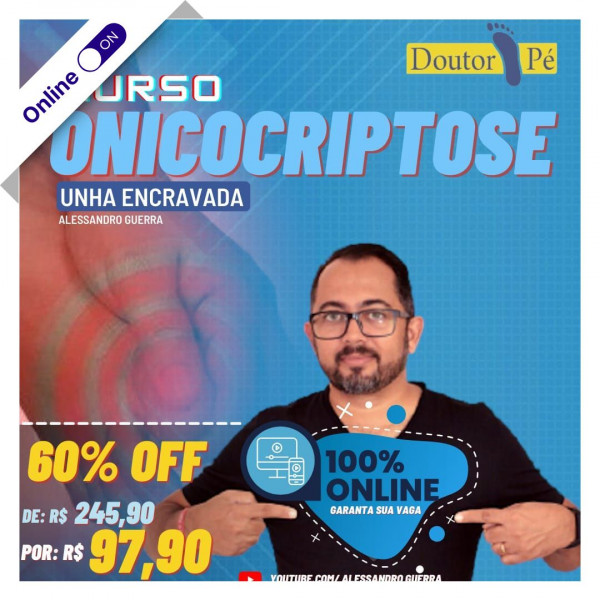 Curso de Podologia Online - Onicocriptose e Unha Encravada