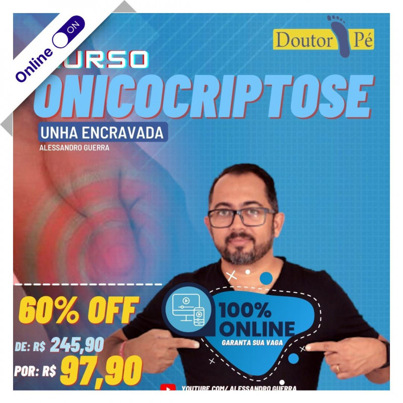 Onicocriptose, Aperfeiçoamento em Unha Encravada com Alessandro Guerra - Doutor Pé