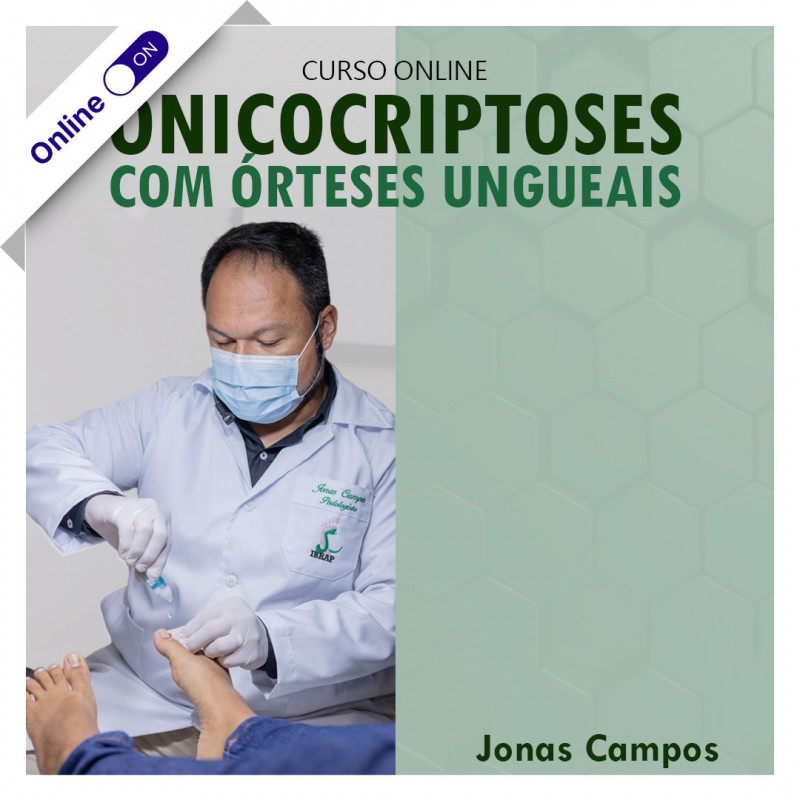 Curso de Podologia Online - Onicocriptoses e Órteses Ungueais 