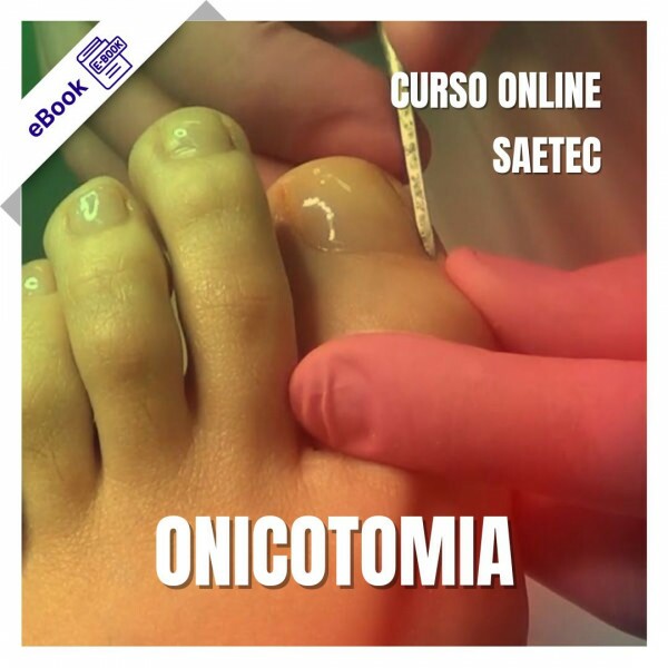 Curso de Podologia Online - Onicotomia