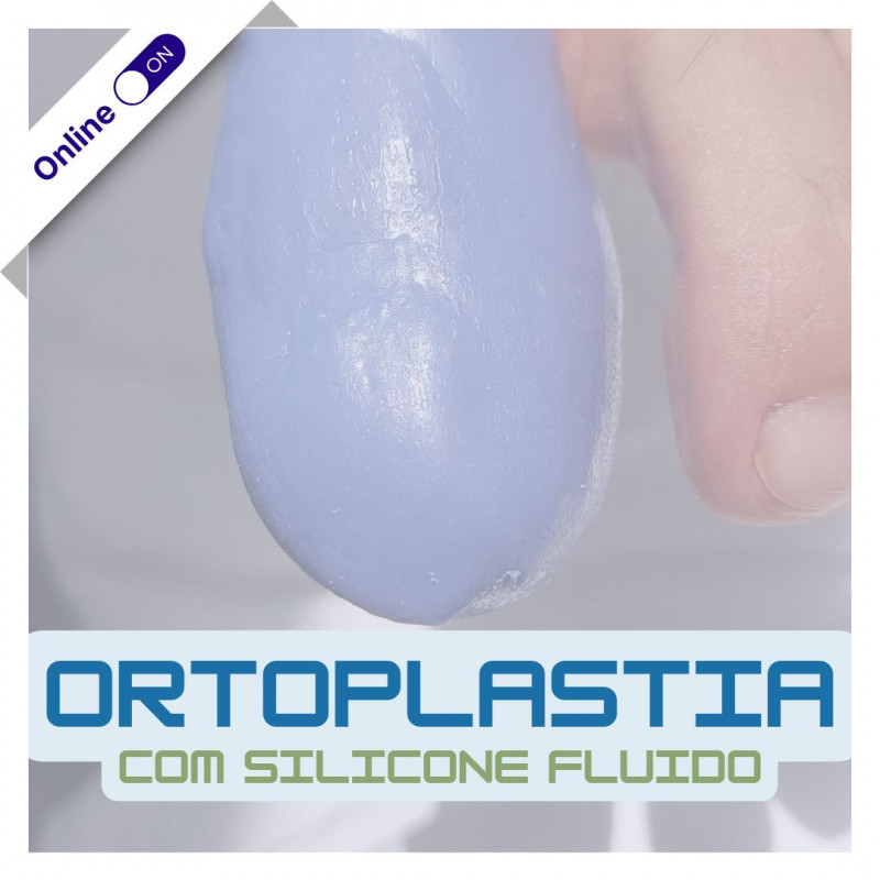 Curso de Podologia Online - Ortoplastia com Silicone Fluido