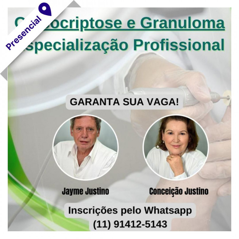 Curso Onicocriptose e Granuloma (Especialização Profissional) - JCA Podologia