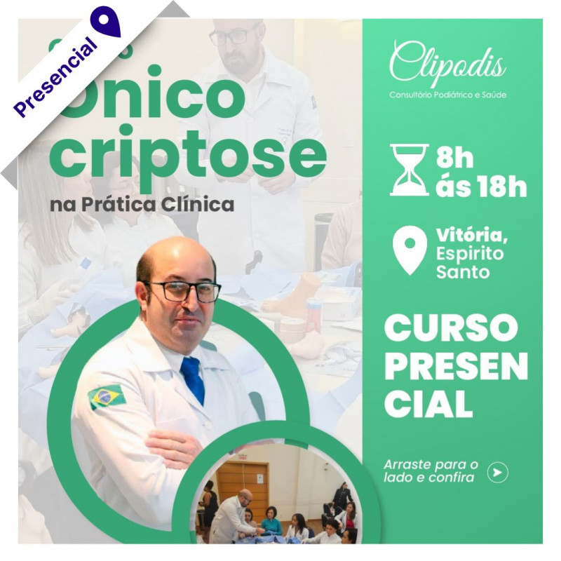 Curso de Onicocriptose na Prática Clínica