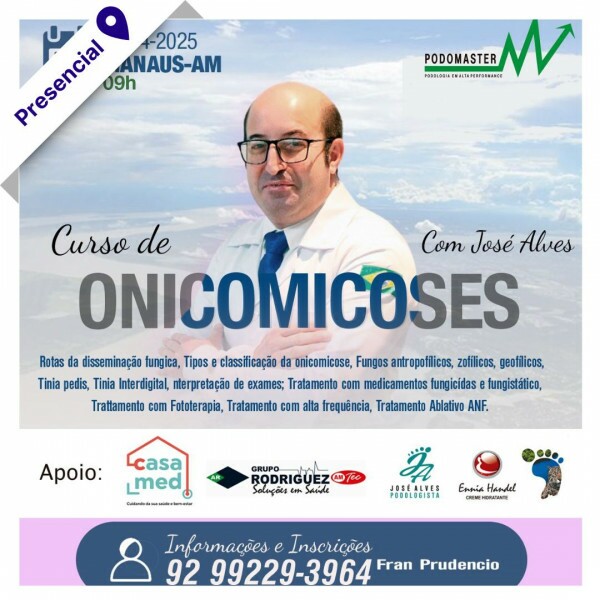 Curso de Podologia Presencial - Onicomicoses com José Alves