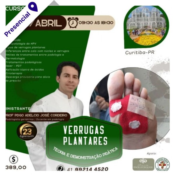 Curso de Podologia Presencial - Verrugas Plantares 