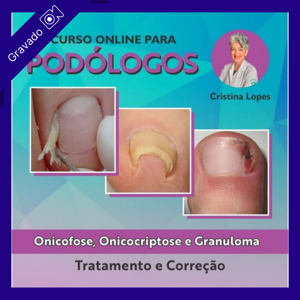Onicologia Avançada - EXTENSIO CURSOS ONLINE